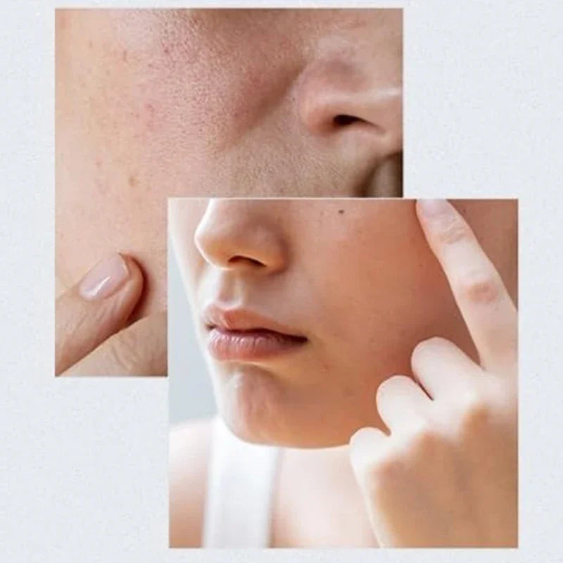 Anua Birch 70% Moisture Boosting Serum